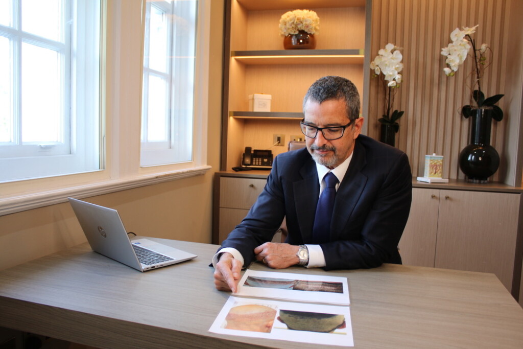 doctor analysing pictures of scalps