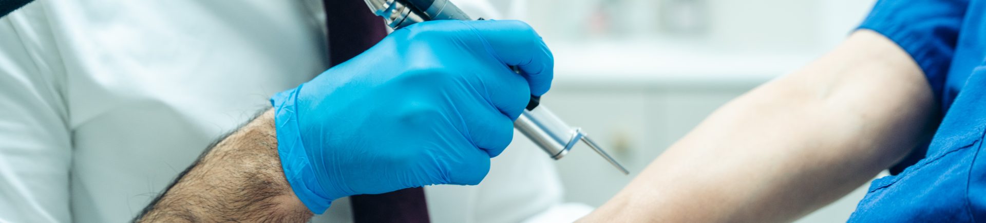 laser treatment on forearm