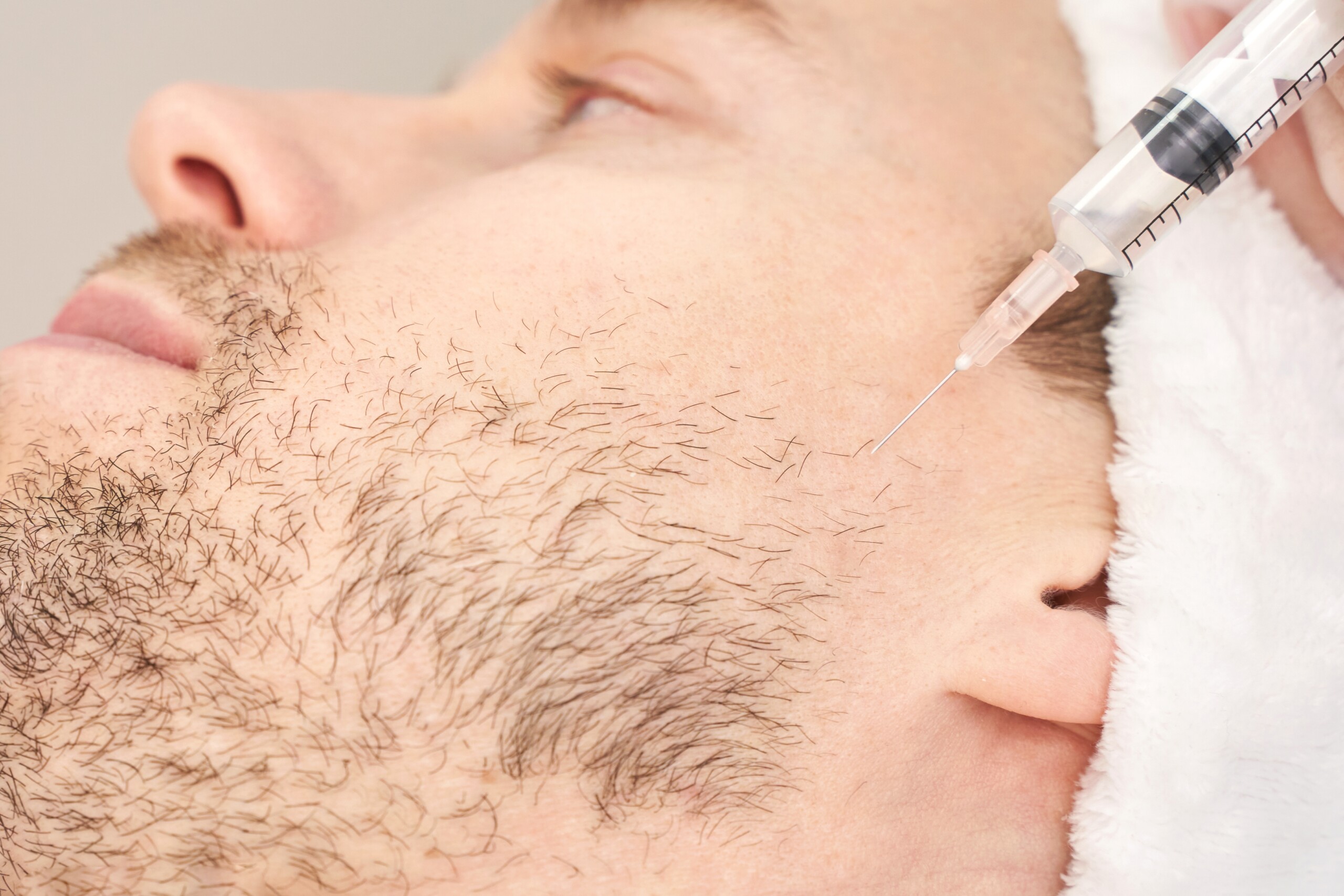 scar filler for a man in his face