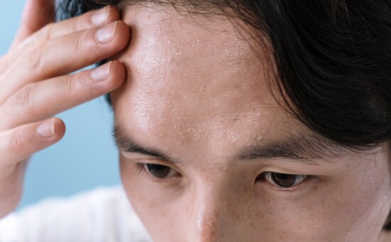 Patient with eczema marks on the forehead