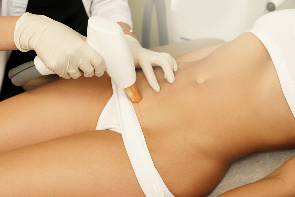 doctor treating woman's c-section scar