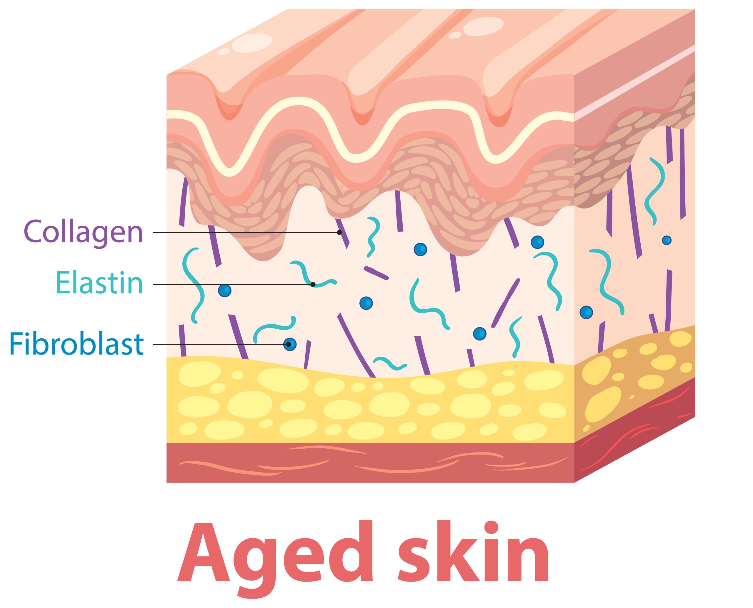 aged skin with collagen