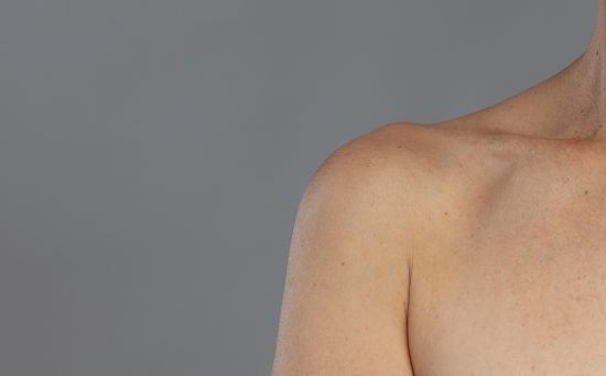 Close-up of a middle-aged woman's bare shoulder and collarbone, showing natural skin texture and signs of aging and pigmentation, against a neutral grey background.
