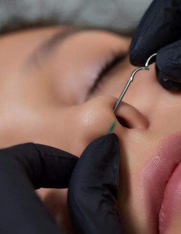 Close-up of a nose piercing procedure being performed with a needle by a practitioner wearing black gloves